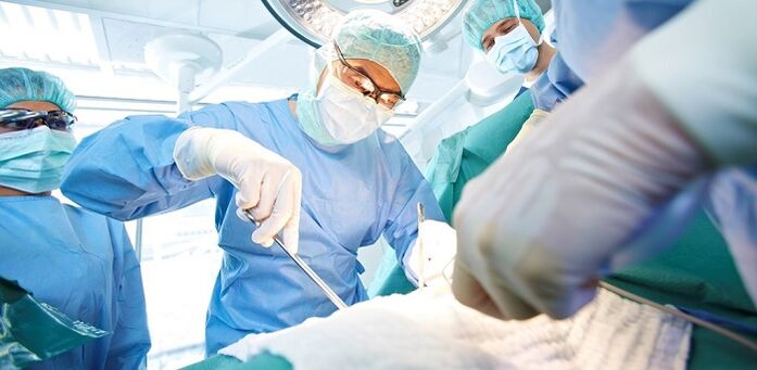 Operazione per aumentare un membro